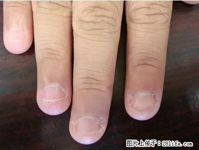 剪指甲、挖耳屎，这些日常小动作竟隐藏大危害！ - 巴彦淖尔盟生活资讯 - 巴彦淖尔盟28生活网 bycem.28life.net